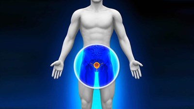 Можно ли вылечить рак или это просто отсрочка летального исхода?